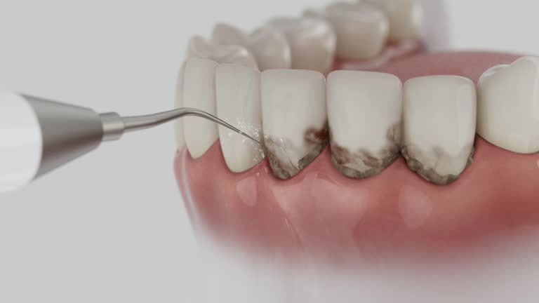 Reliable Dental contractor in Bay Harbor Islands, FL by Dentist Open Now
